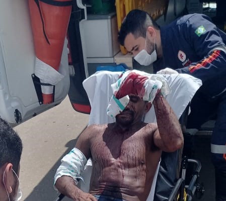 “Branquelo” invade casa e aplica diversas facadas em vizinho em Parauapebas