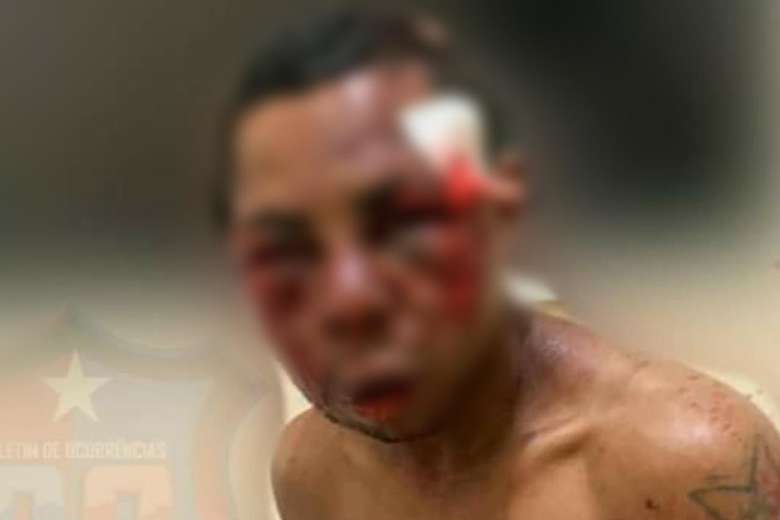 Foragido da Justiça fica com “cara estragada” ao tentar assaltar lutadora de artes marciais no Pará