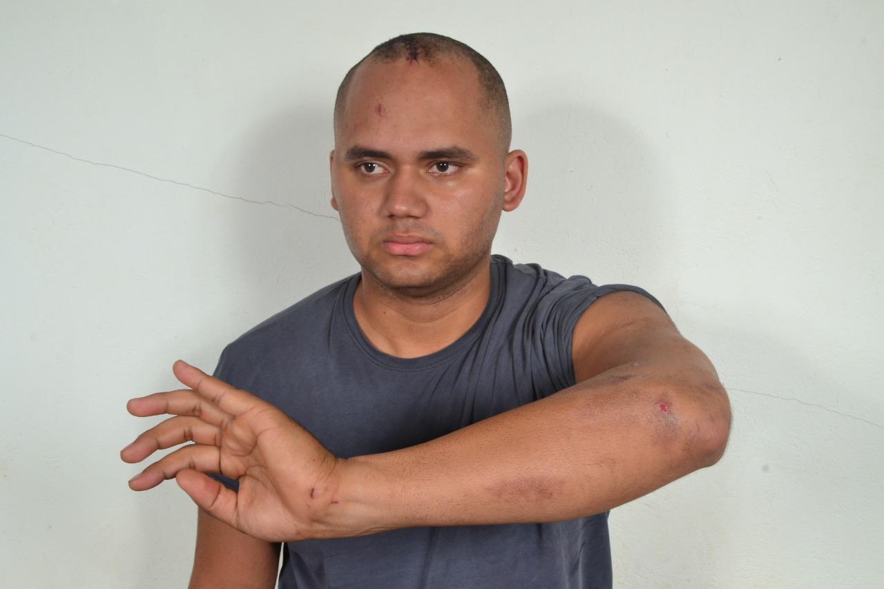 PM acusado de matar jovem a tiros apresenta versão de legítima defesa em Parauapebas