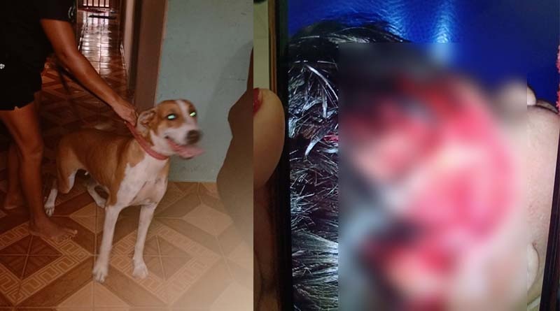 Cachorro arranca couro cabeludo de criança no Pará