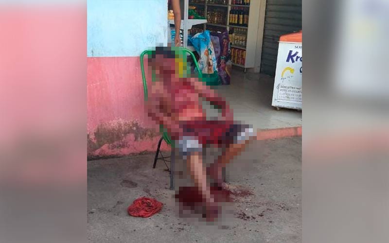 Suspeito ataca desafeto a golpes de facão em Parauapebas