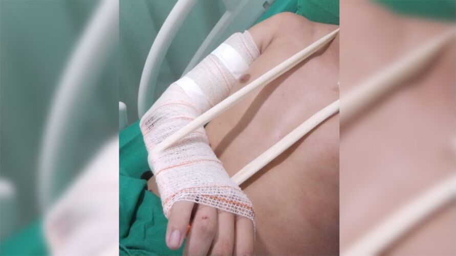 Universitário é brutalmente espancado por três homens no Pará