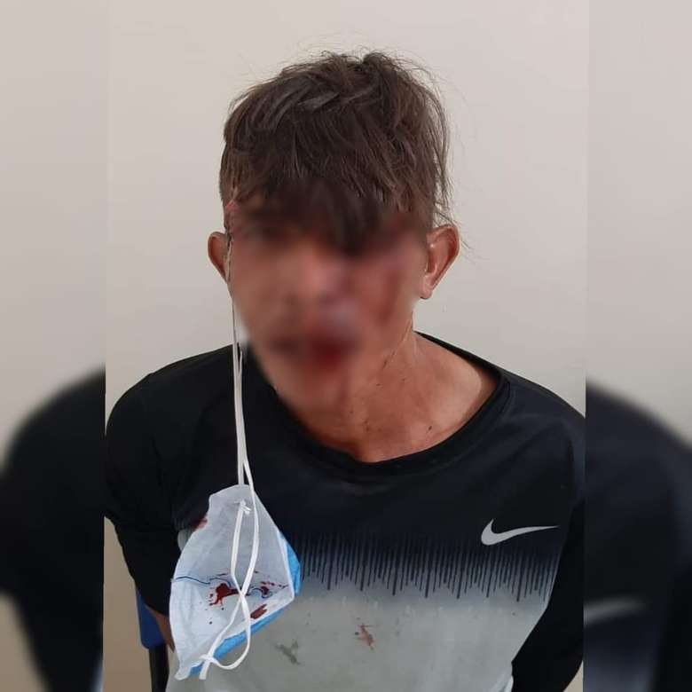 ‘Caveira’ agride o próprio pai com tijolada na cabeça no Pará