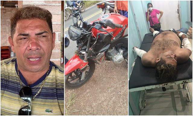 Milionário do Brega sofre grave acidente de moto e é internado às pressas
