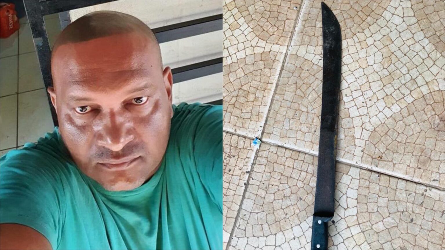 Comerciante agredido com facão por cunhado passa por cirurgia e recebe alta