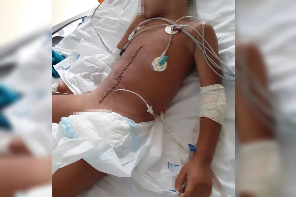 Criança é arremessada de van escolar e sofre ferimentos graves
