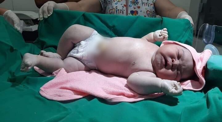 Bebê ‘gigante’ nasce com quase 7 quilos no sudeste do Pará