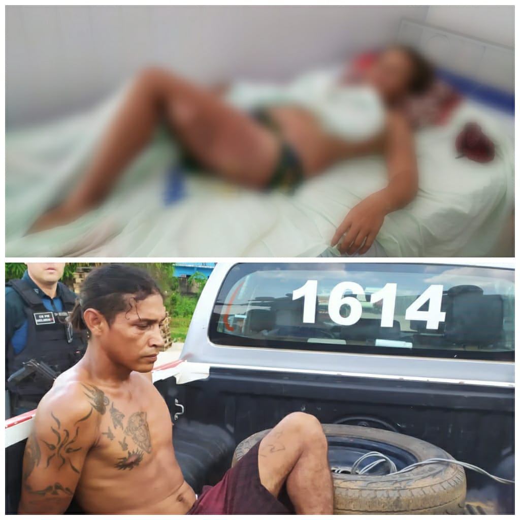 Marido joga gasolina e coloca fogo na própria esposa no interior do Pará