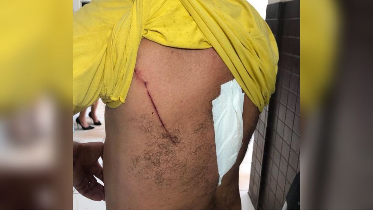 Empresário tenta evitar briga e acaba agredido com ferramenta no Pará