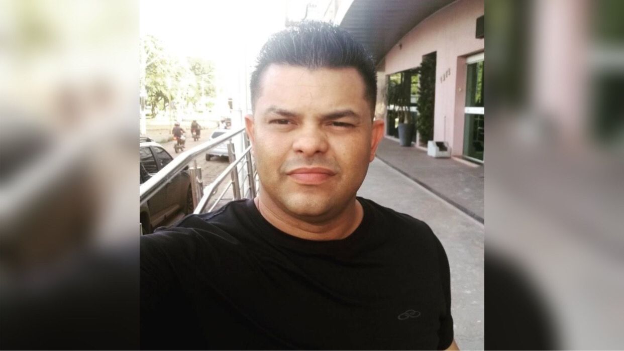 Homem é internado em estado grave após ser queimado pela companheira em Marabá