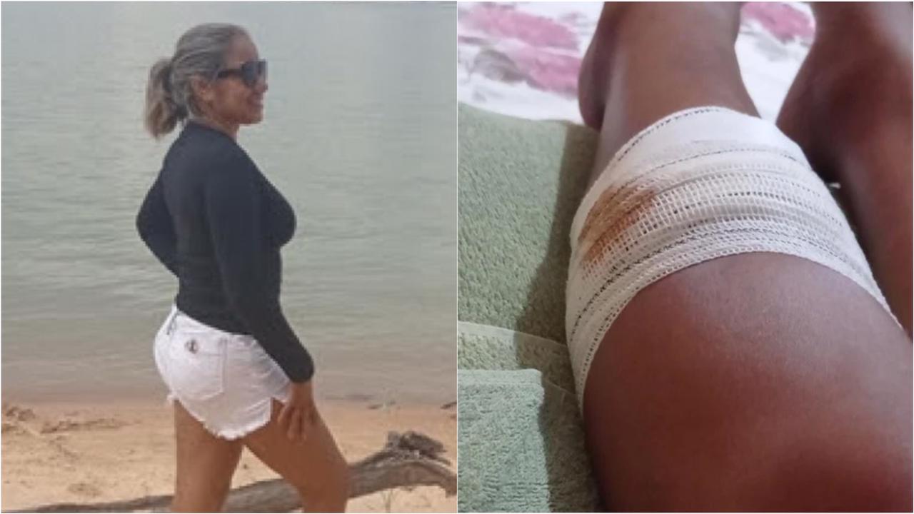 Piranhas atacam professora durante banho em praia no oeste do Pará