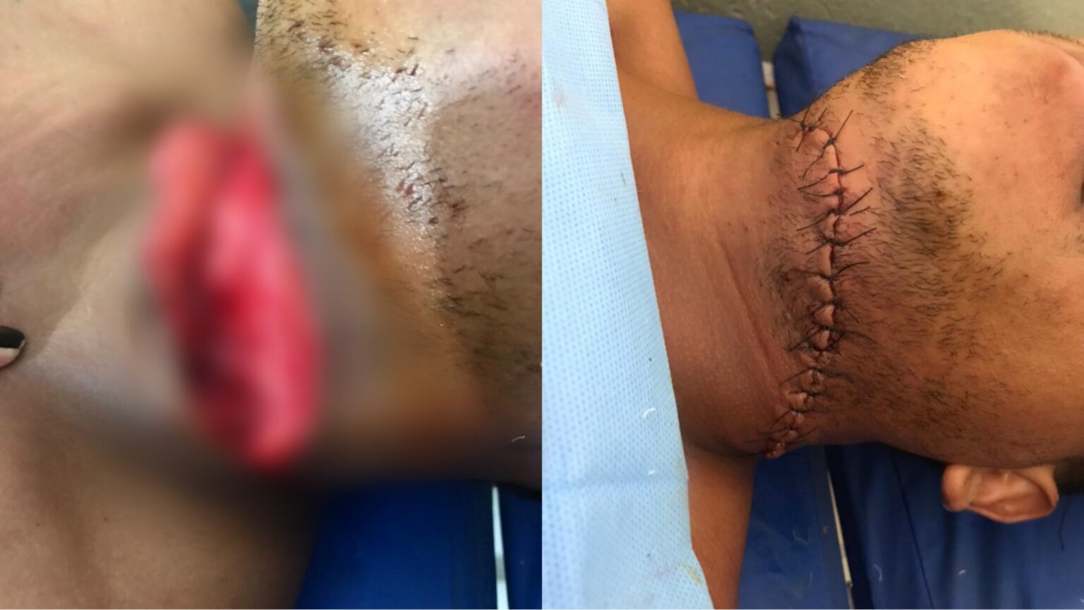 Esposa degola o próprio marido em garimpo no interior do Pará