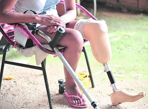 Homem ameaça de morte mulher com perna amputada, em Marabá