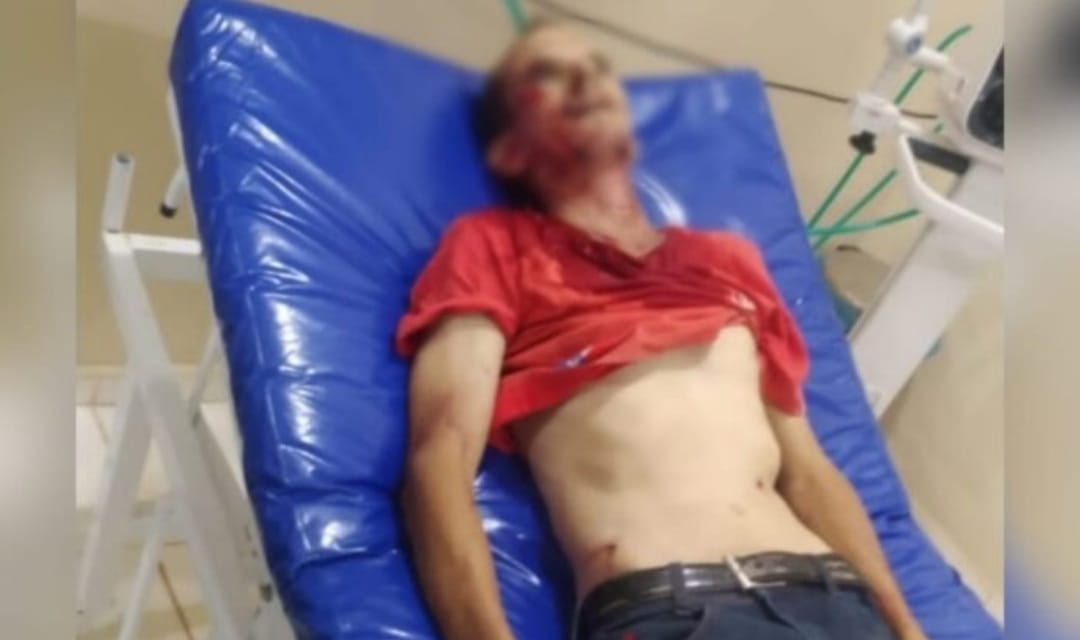 Dupla ‘fuzila’ homem que roçava às margens da Rodovia Transamazônica