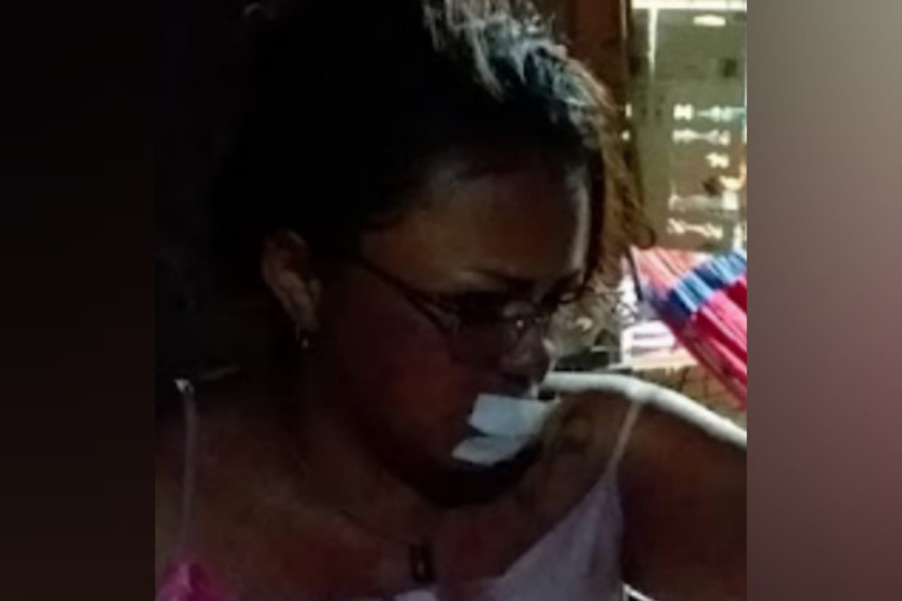 Mulher tem parte dos lábios arrancados após separar briga no Pará