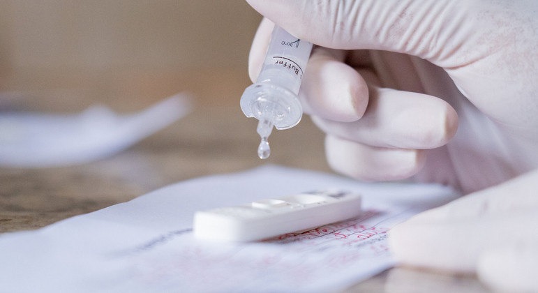 Sespa confirma primeiro caso da variante Ômicron em Marabá