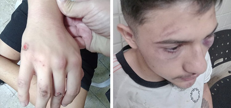 Jovem em tratamento oncológico denuncia tortura em festa no Pará