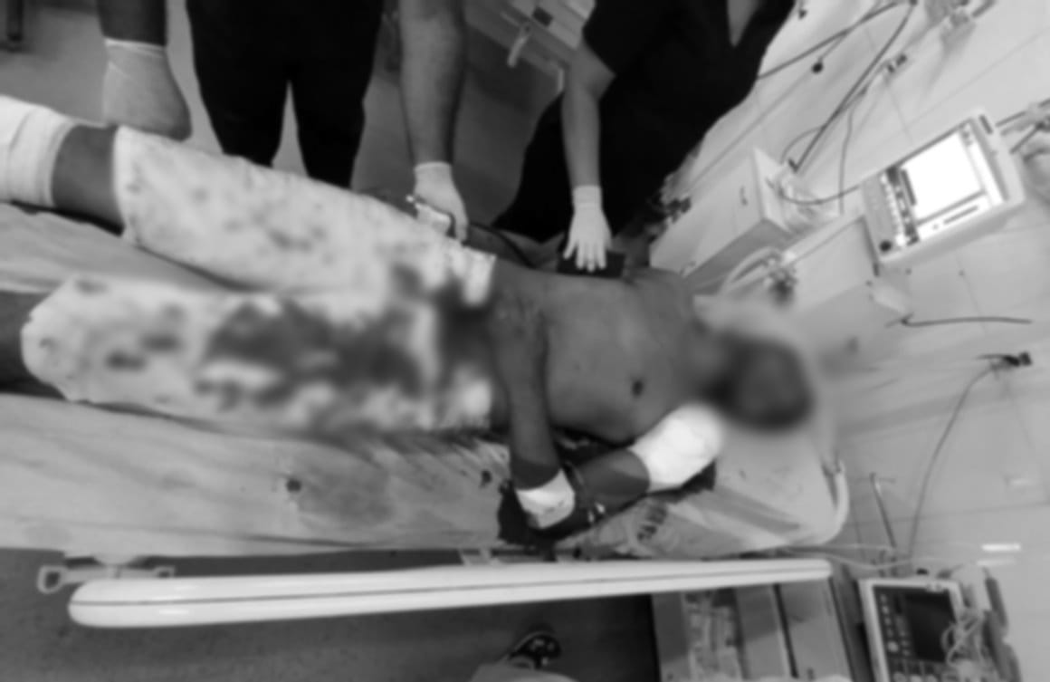 Homem é esfaqueado em Parauapebas por supostas dívidas