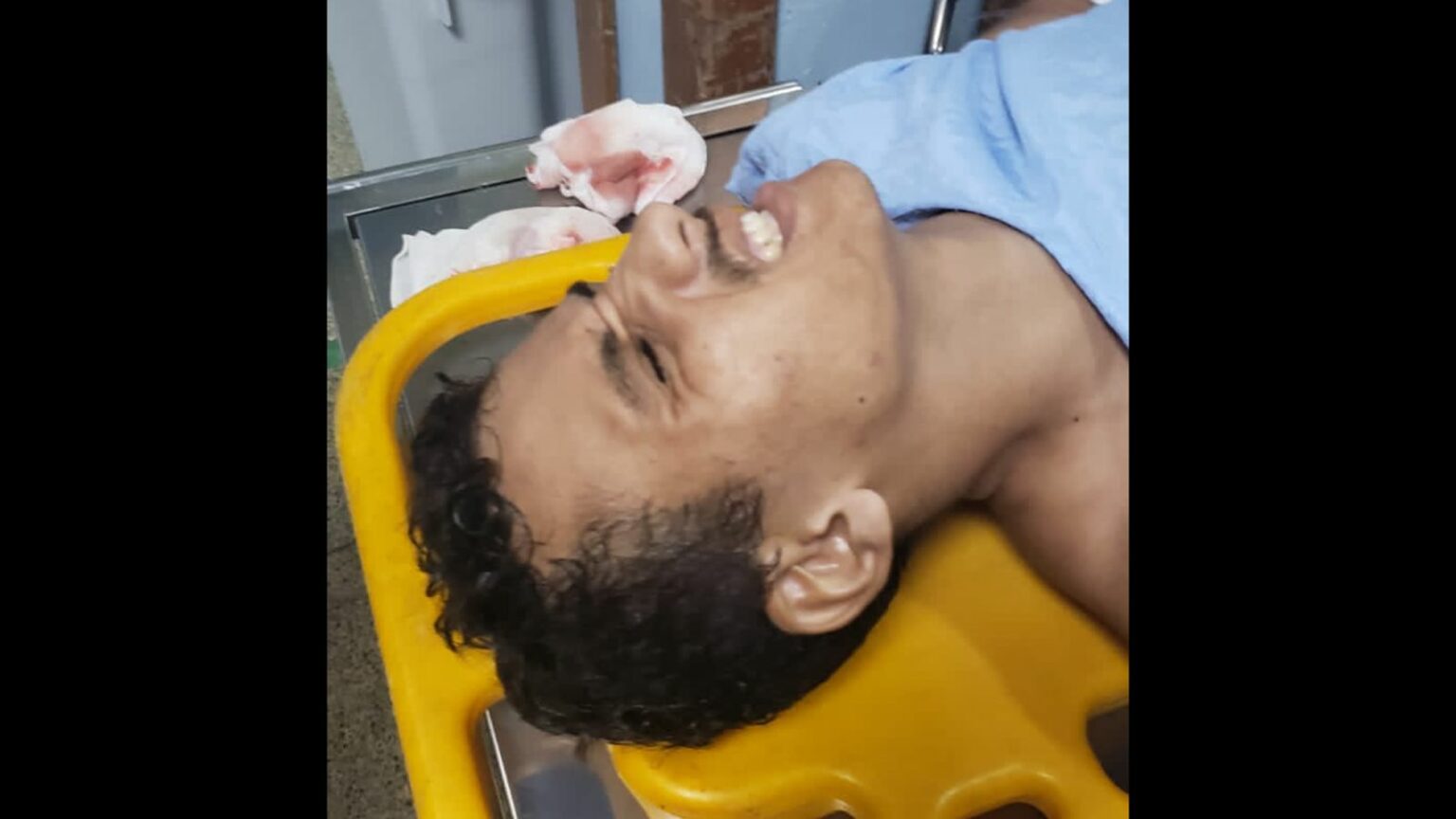 Assaltante erra tiro e acerta comparsa em Marabá