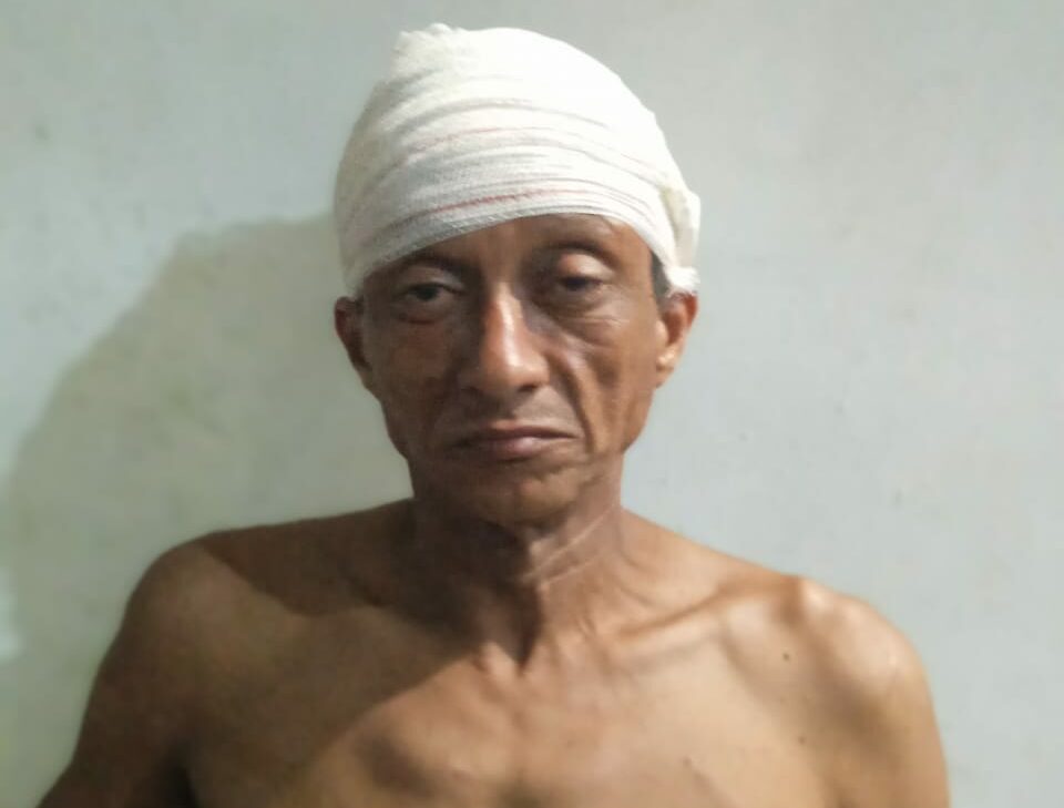 Homem não aceita término e incendeia casa da ex em Marabá