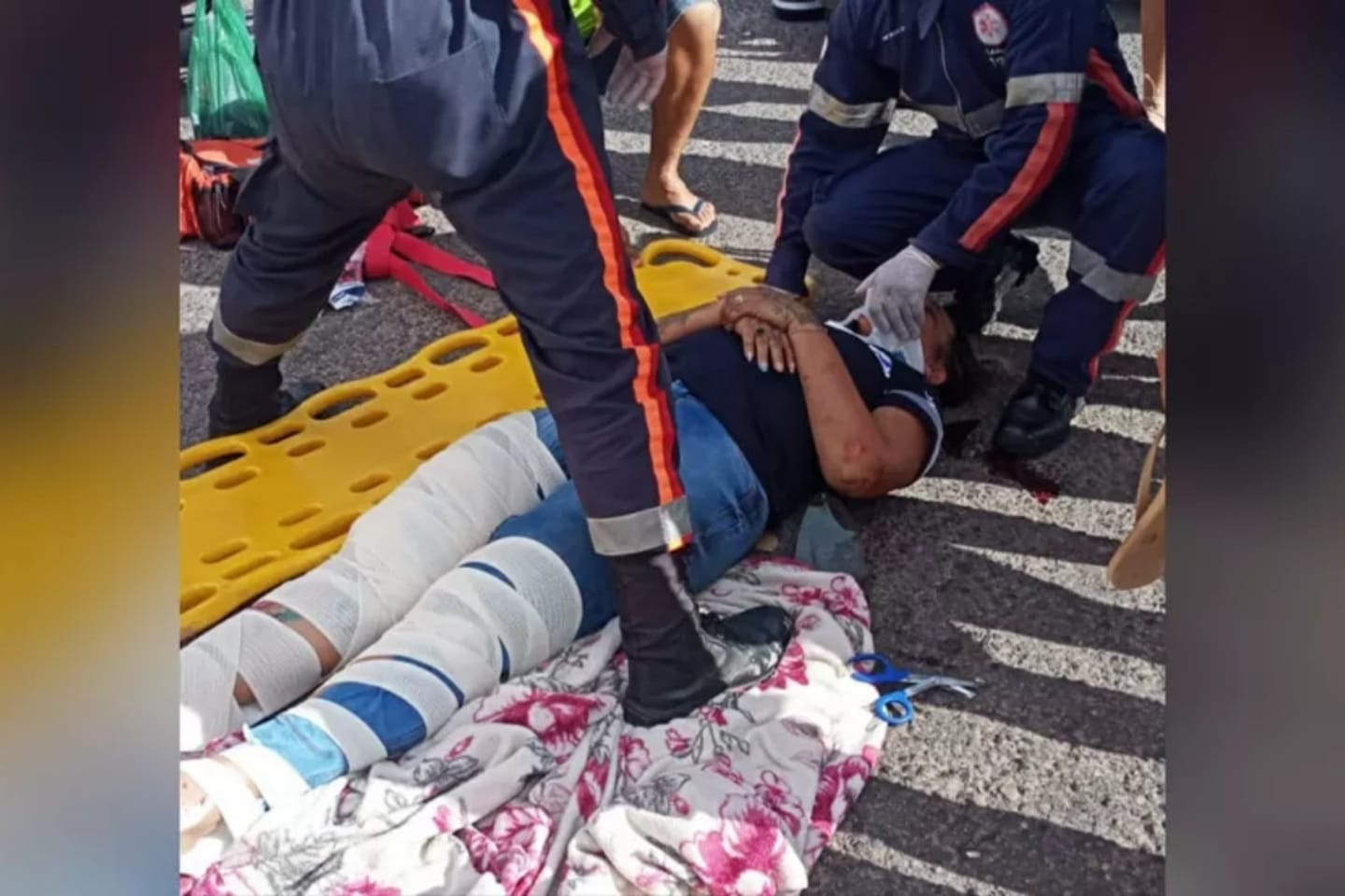Acidente entre carro e moto deixa duas pessoas feridas no oeste do Pará