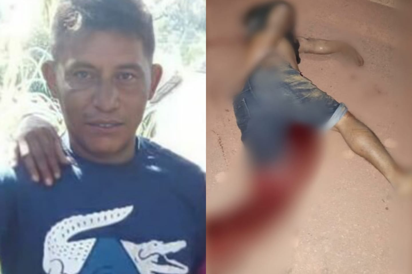 Homem tem membros decepados em grave acidente na BR-230