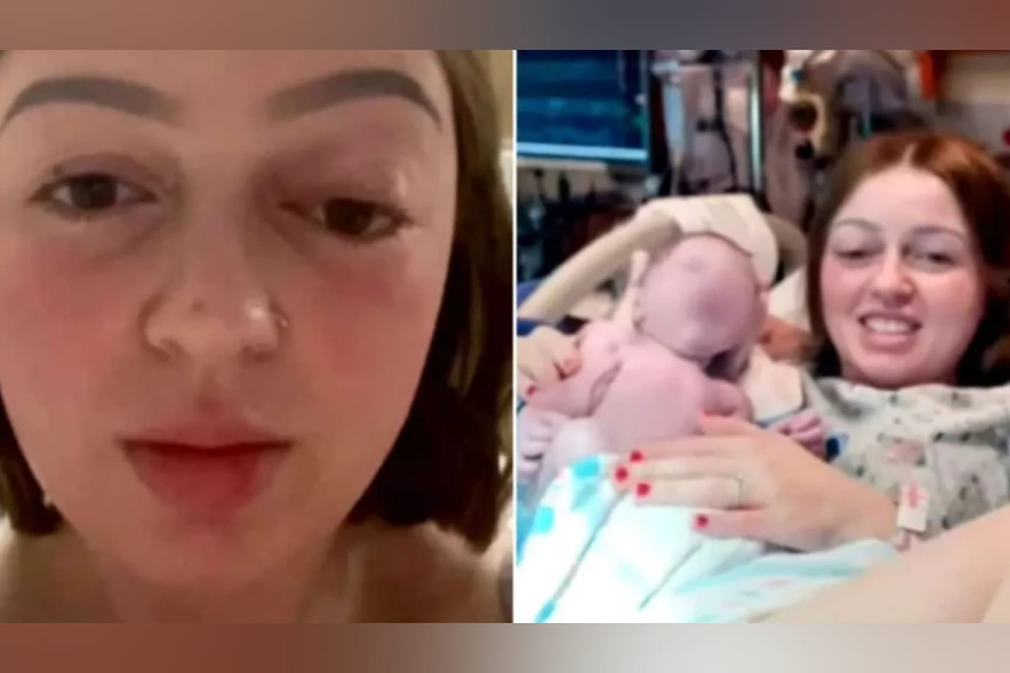 Força em parto normal faz olho de mulher “saltar para fora”