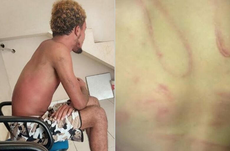 Homem é preso por maltratar irmão de 8 anos no Pará