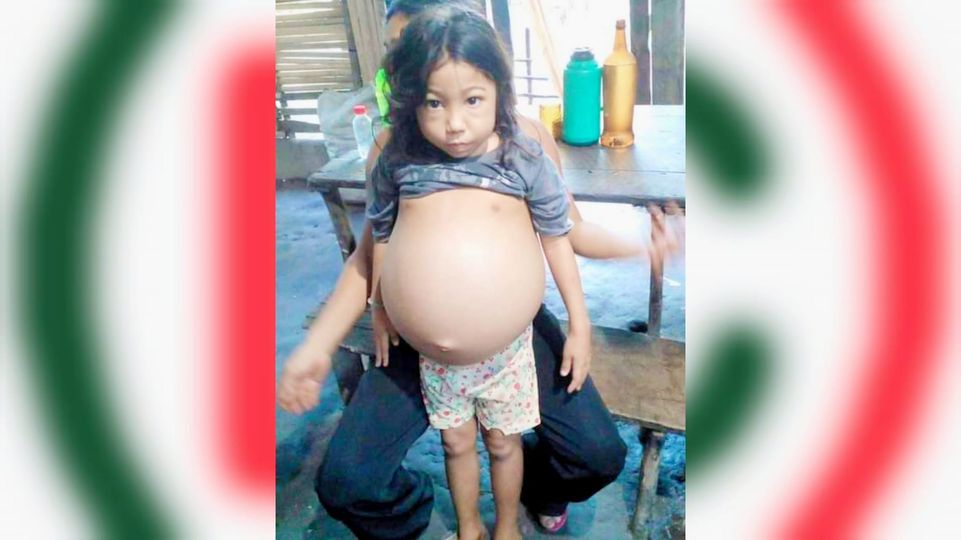 ‘Vaquinha’ arrecada doações para tratamento de criança com doença misteriosa no interior do Pará