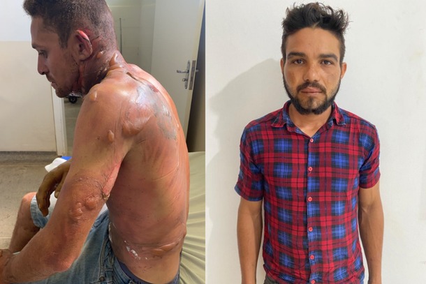 Homem joga álcool e toca fogo em desafeto no sudeste do Pará