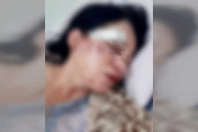Moradora é espancada por vizinhos após denúncia de som alto