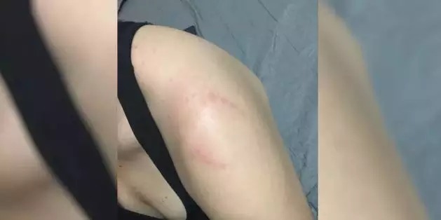 VÍDEO: Homem morde mulher após esbarrão na academia