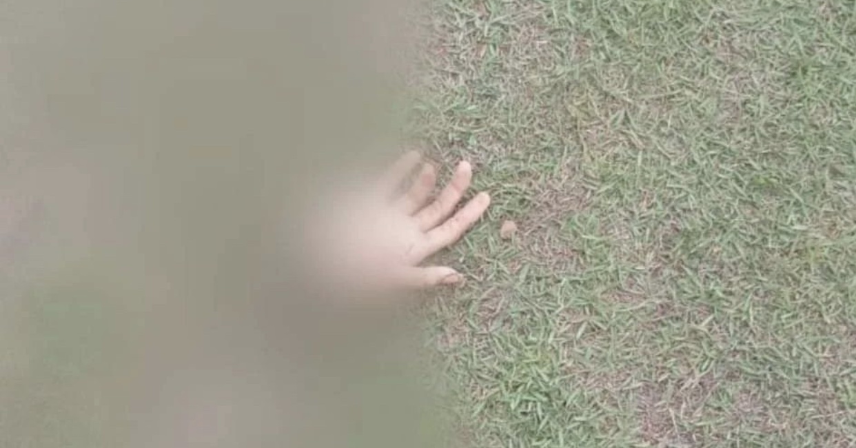 Homem tem mão decepada por causa de tatuagem de flor em Marabá