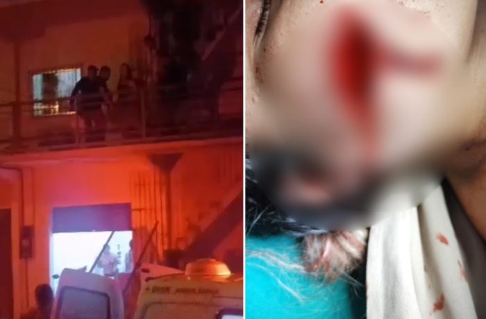 Homem atira no rosto de uma mulher e na cabeça de um jovem no interior do Pará
