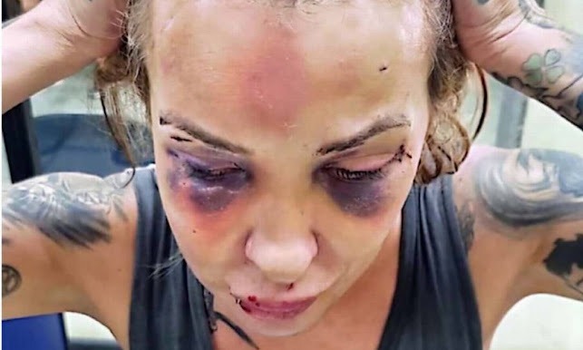Polícia prende homem que torturou namorada com cassetete e soco-inglês por três dias
