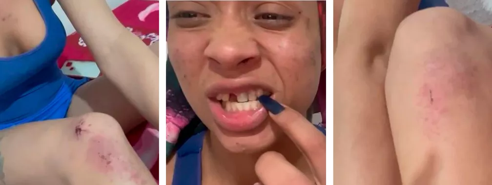 VÍDEO: Homem agride mulheres trans com socos e quebra dente de uma delas