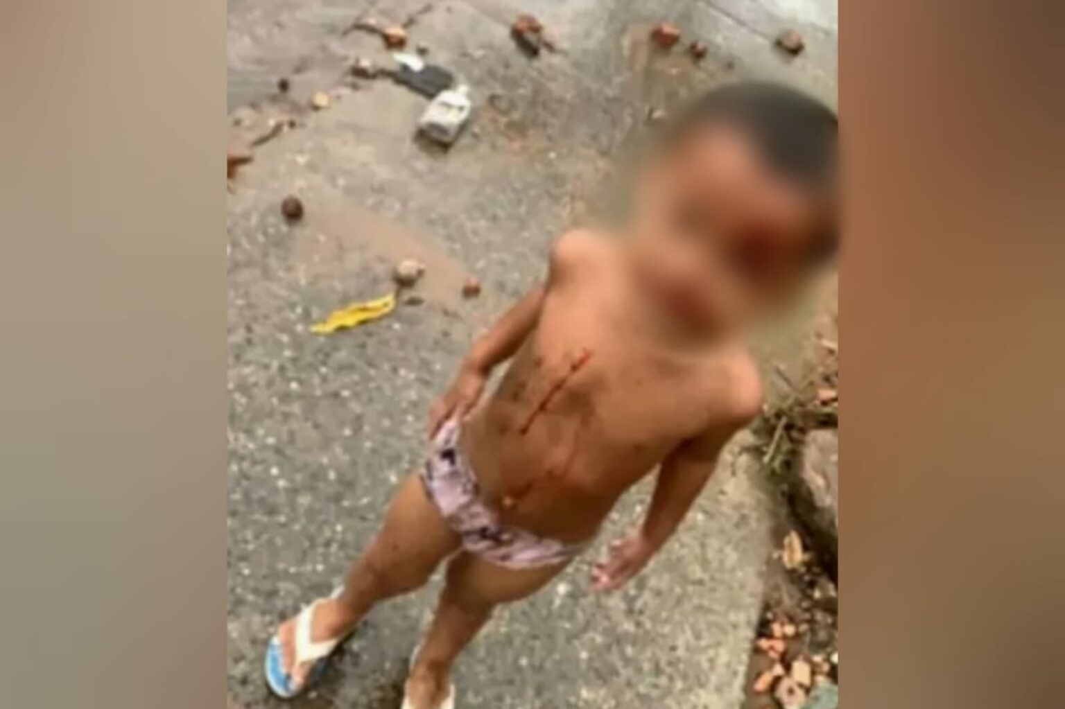 Criança ferida é encontrada sozinha caminhando em rodovia no Pará