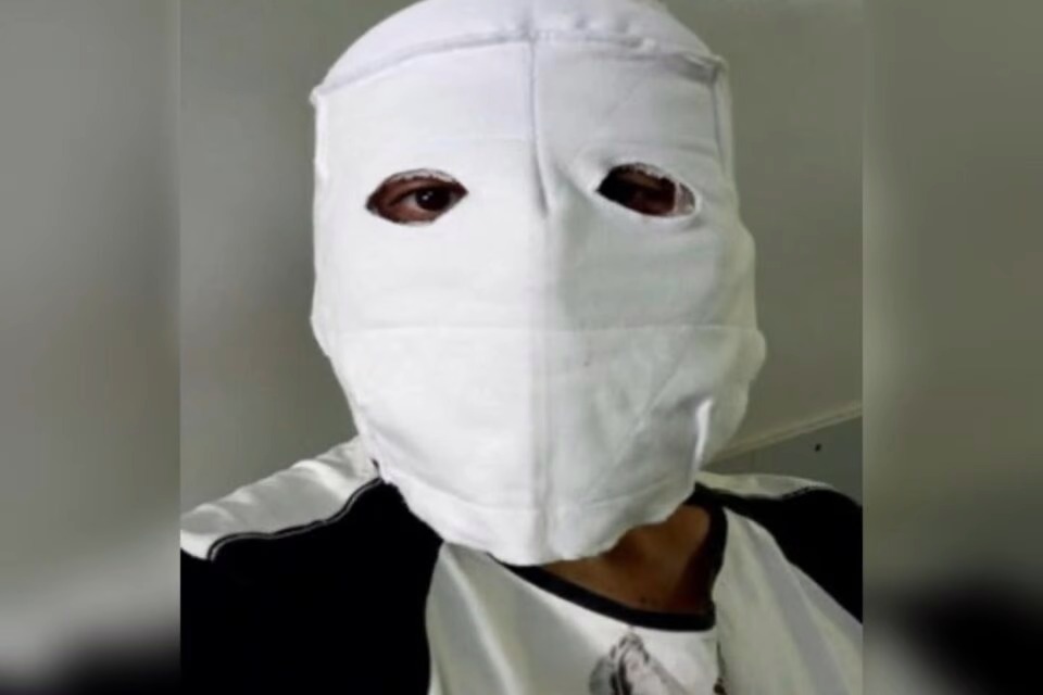 Jovem tem rosto desfigurado com soda cáustica pela ex-namorada