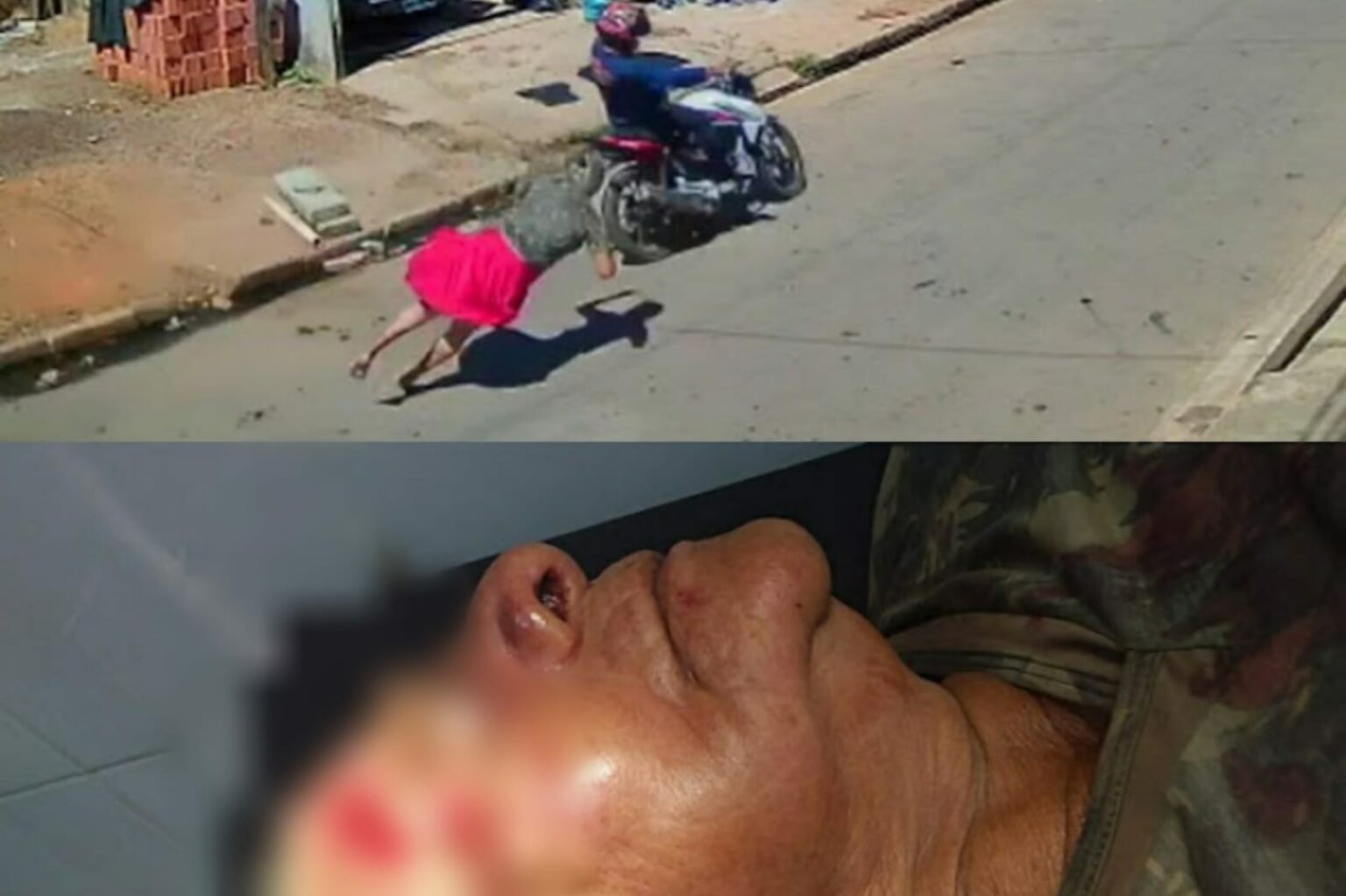 Idosa é atropelada por motociclista em Parauapebas