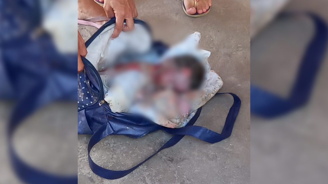 VÍDEO: Mulher faz o próprio parto e carrega filho morto dentro de bolsa no Pará