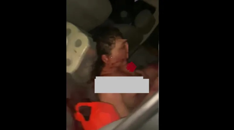 Homem atropela, espanca e estupra jovem no interior do Pará