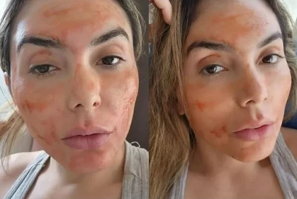Influencer usa sangue menstrual no skincare e divide opiniões