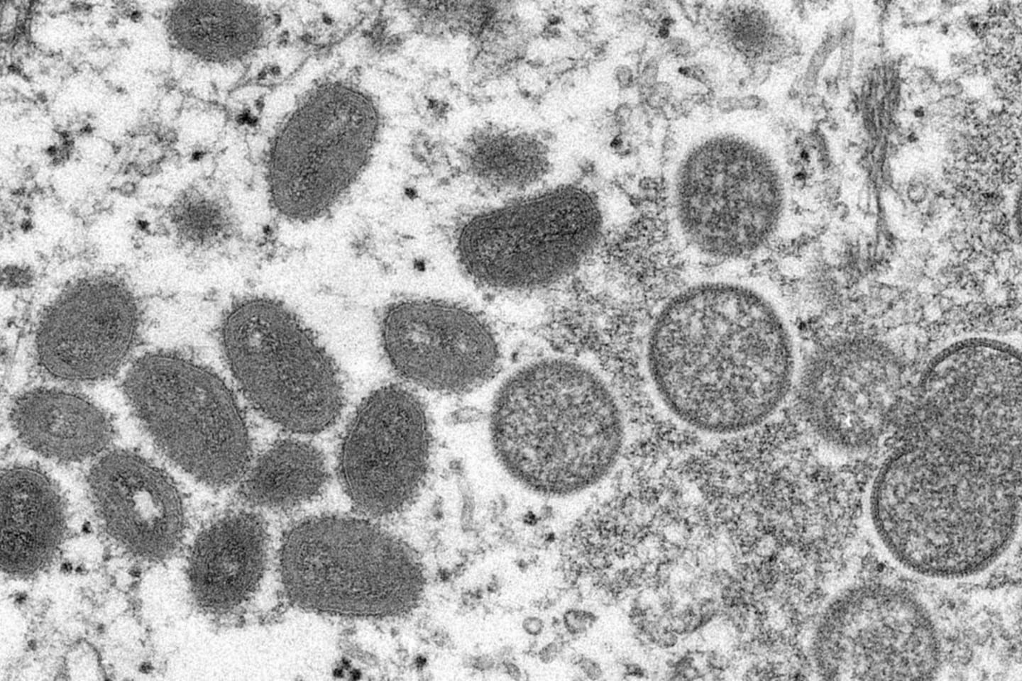 Sobe para 142 o número de casos de varíola dos macacos no Brasil