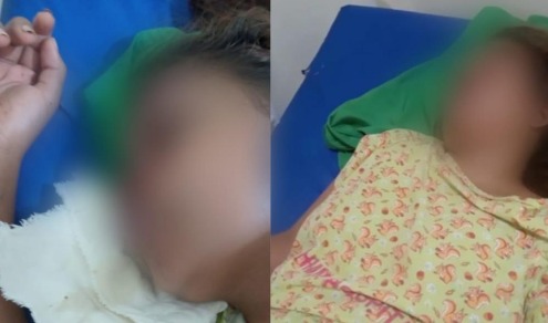 Garçonete fica em coma após ser agredida por cliente que furtou celular no Pará
