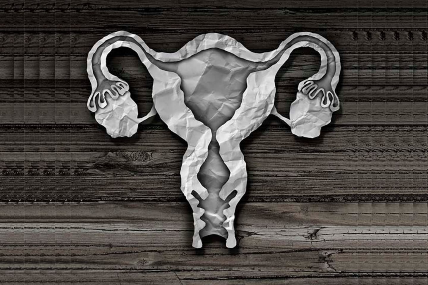 Homem passa 20 anos menstruando e descobre que tem útero e ovários