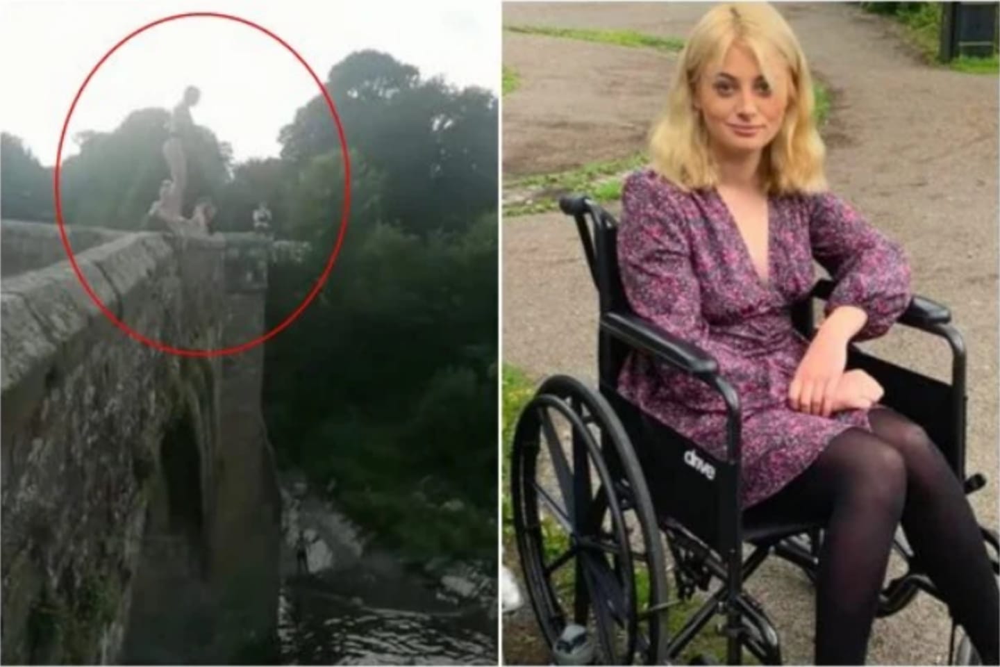 Jovem tem coluna vertebral destroçada após pular de ponte de 15 metros
