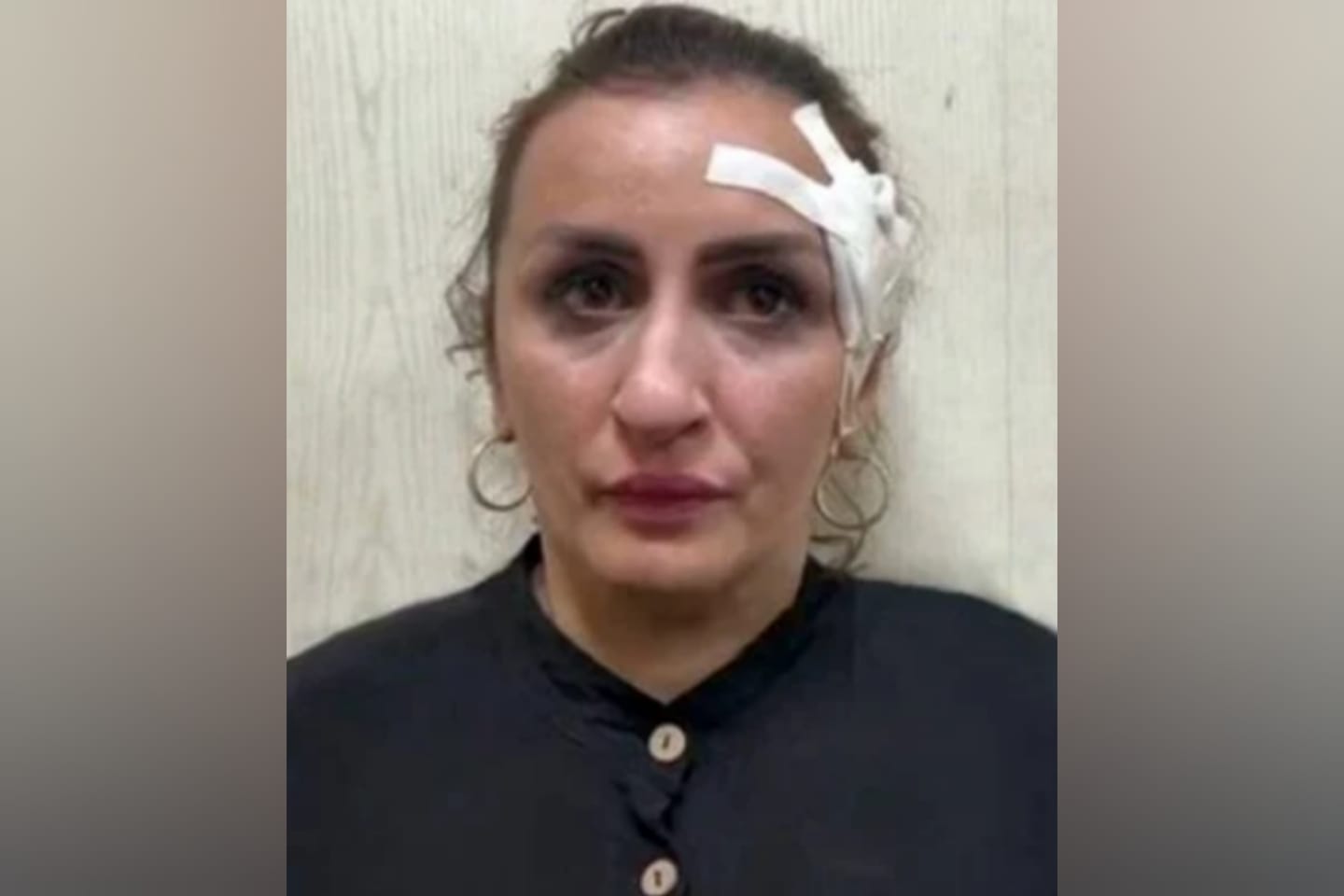 Mulher é presa após vender o filho para financiar plástica no nariz