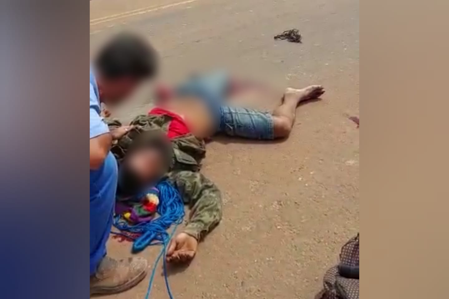 Acidente entre carreta e moto arranca perna de motociclista no Pará