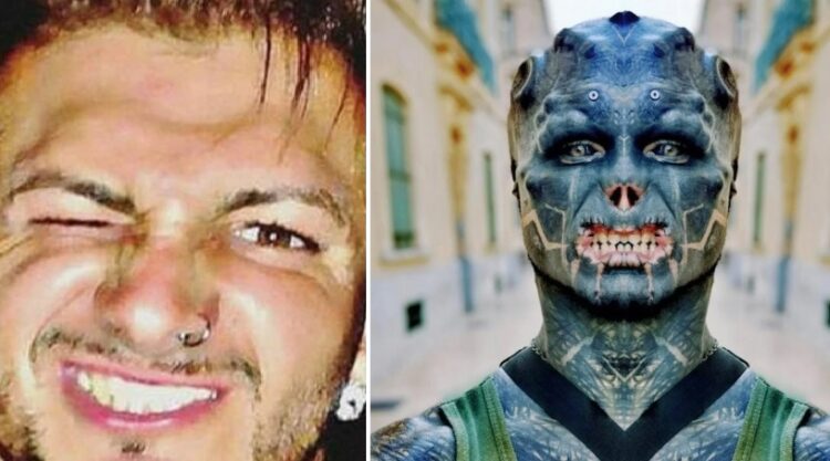 Homem pretende amputar uma das pernas para se parecer com alienígena