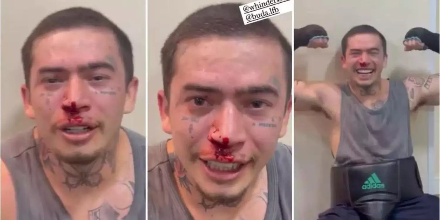 Whindersson Nunes posta fotos com nariz ensanguentado após treino de MMA